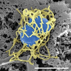 Scanning electron micrograph of a single "N. meningitidis" cell (colorized in blue) with its adhesive pili (colorized in yellow). The scale bar corresponds to 1 µm. Scanning electron micrograph of a single "N. meningitidis" cell (colorized in blue) with its adhesive pili (colorized in yellow). The scale bar corresponds to 1 µm.
