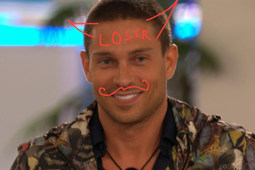 the face of a smug reality star, joey essex, showing his blinding veneers