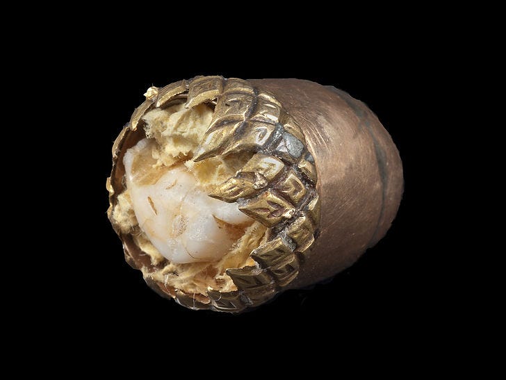 Supposed tooth of Benjamin Franklin, encased in gold acorn. Collection of the American Philosophical Society, Philadelphia, PA. (source) Supposed tooth of Benjamin Franklin, encased in gold acorn. Collection of the American Philosophical Society, Philadelphia, PA. (source)