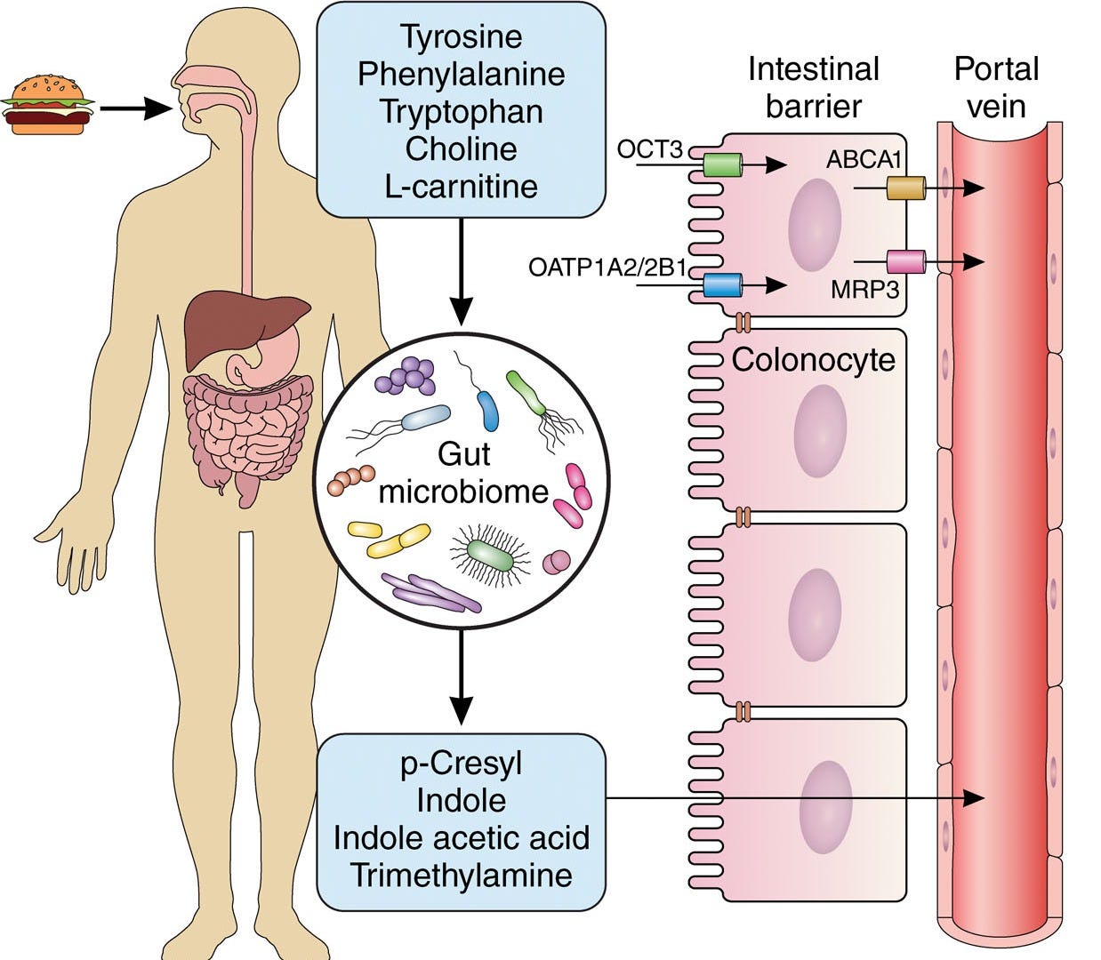 Chronic Kidney Disease Part 2-The clear link between gut dysbiosis and ...
