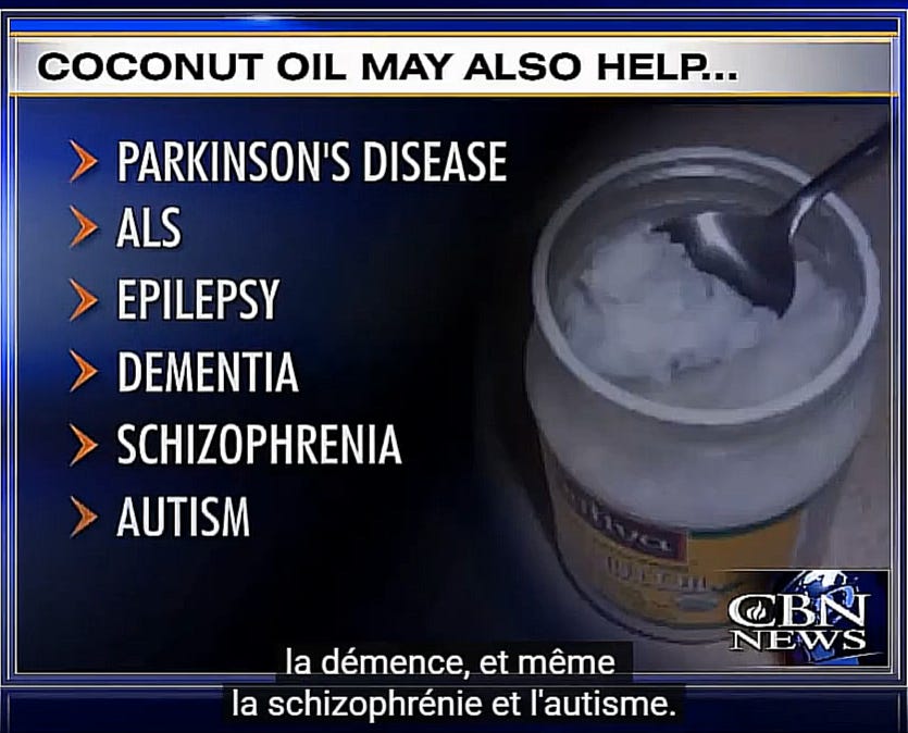 Les bienfaits insoupçonnés de l'huile de coco pour le cerveau