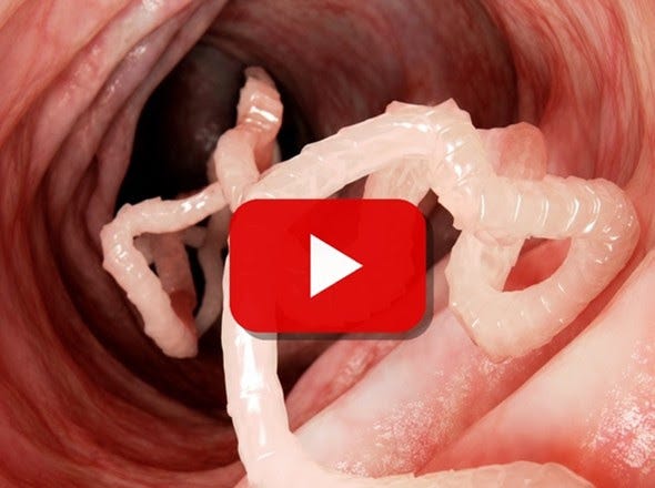 parasite parasite