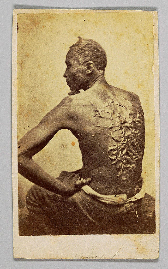 Gordon Under Medical Inspection | National Museum of African American  History and Culture