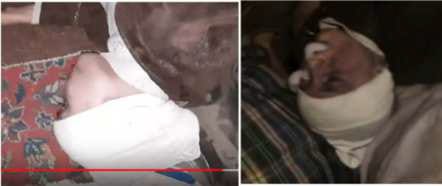 A dog lying on a blanket

AI-generated content may be incorrect.