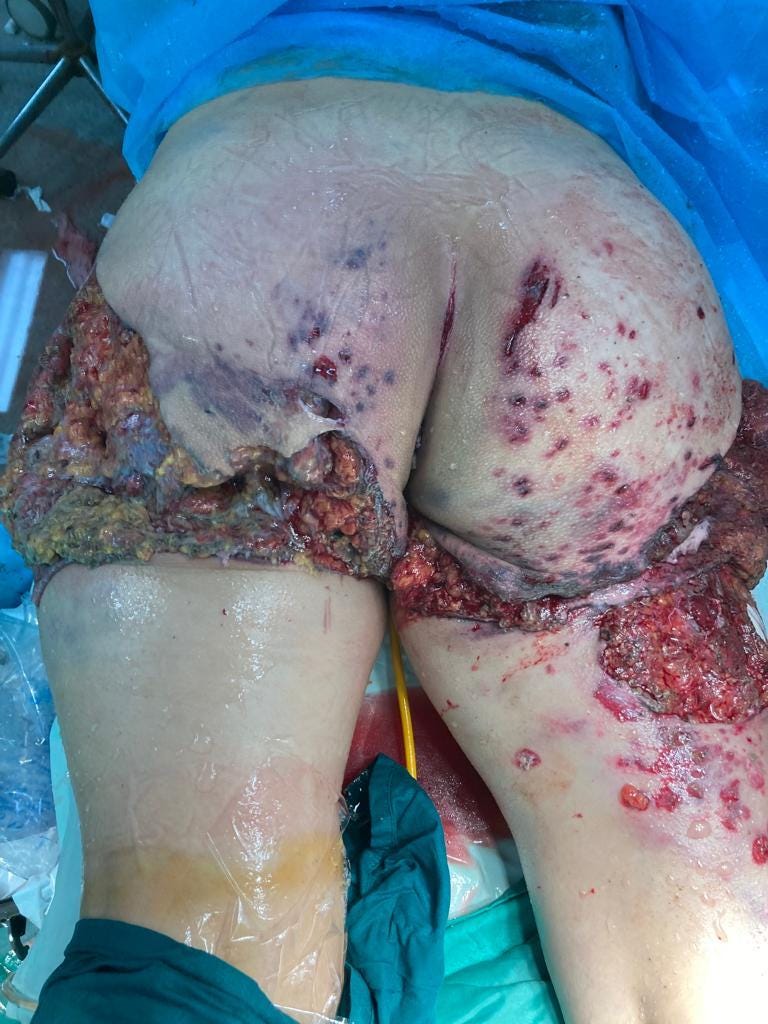 C:\Users\Felix Abt\Downloads\gore\IMG-20240128-WA0021.jpg C:\Users\Felix Abt\Downloads\gore\IMG-20240128-WA0021.jpg