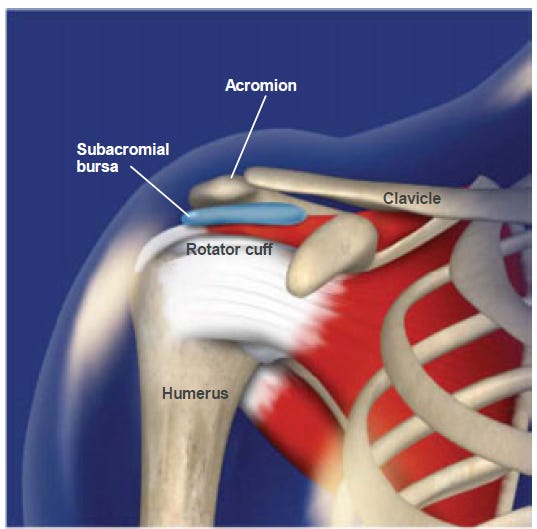 Shoulder Impingement and Subacromial Bursitis | Physiotherapy Manly