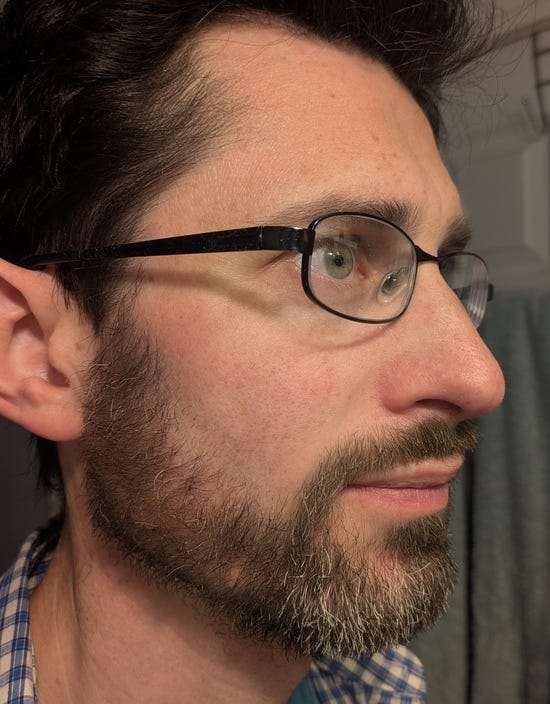 me, after trimming my beard to 3/8 me, after trimming my beard to 3/8