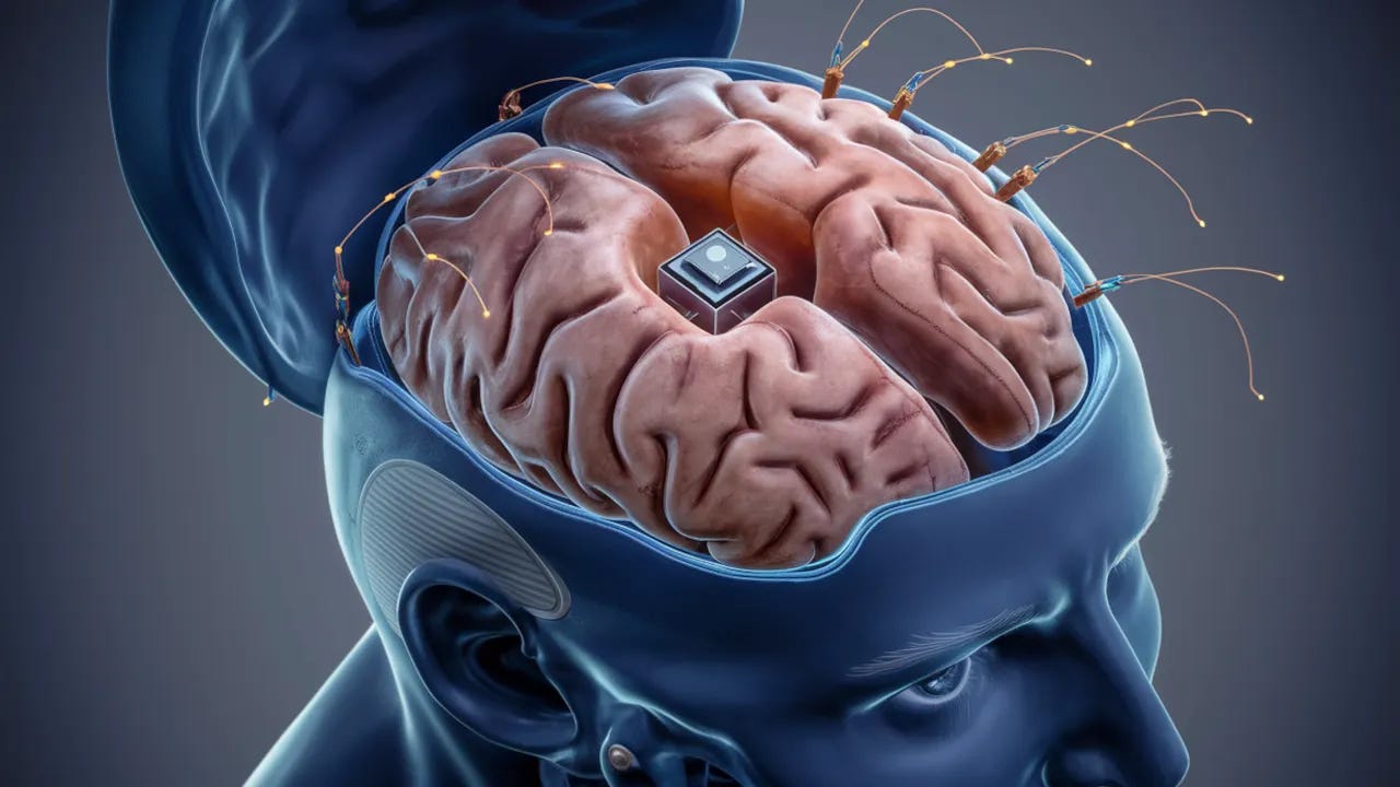 Elon Musk Says Neuralink Needs a Volunteer for 'Telepathy' Brain Implant -  Decrypt