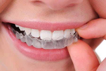invisalign Diamond Provider - Removable and Invisible Orthodontics