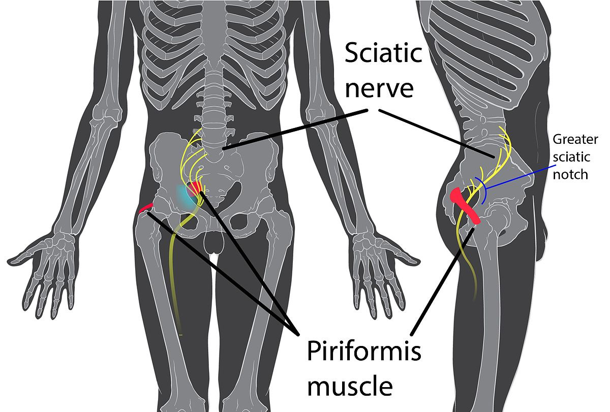 piriformis_syndrome_walking_good