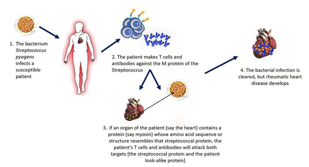 Causes of Autoimmune Diseases - Autoimmune Disease | Johns Hopkins Pathology Causes of Autoimmune Diseases - Autoimmune Disease | Johns Hopkins Pathology