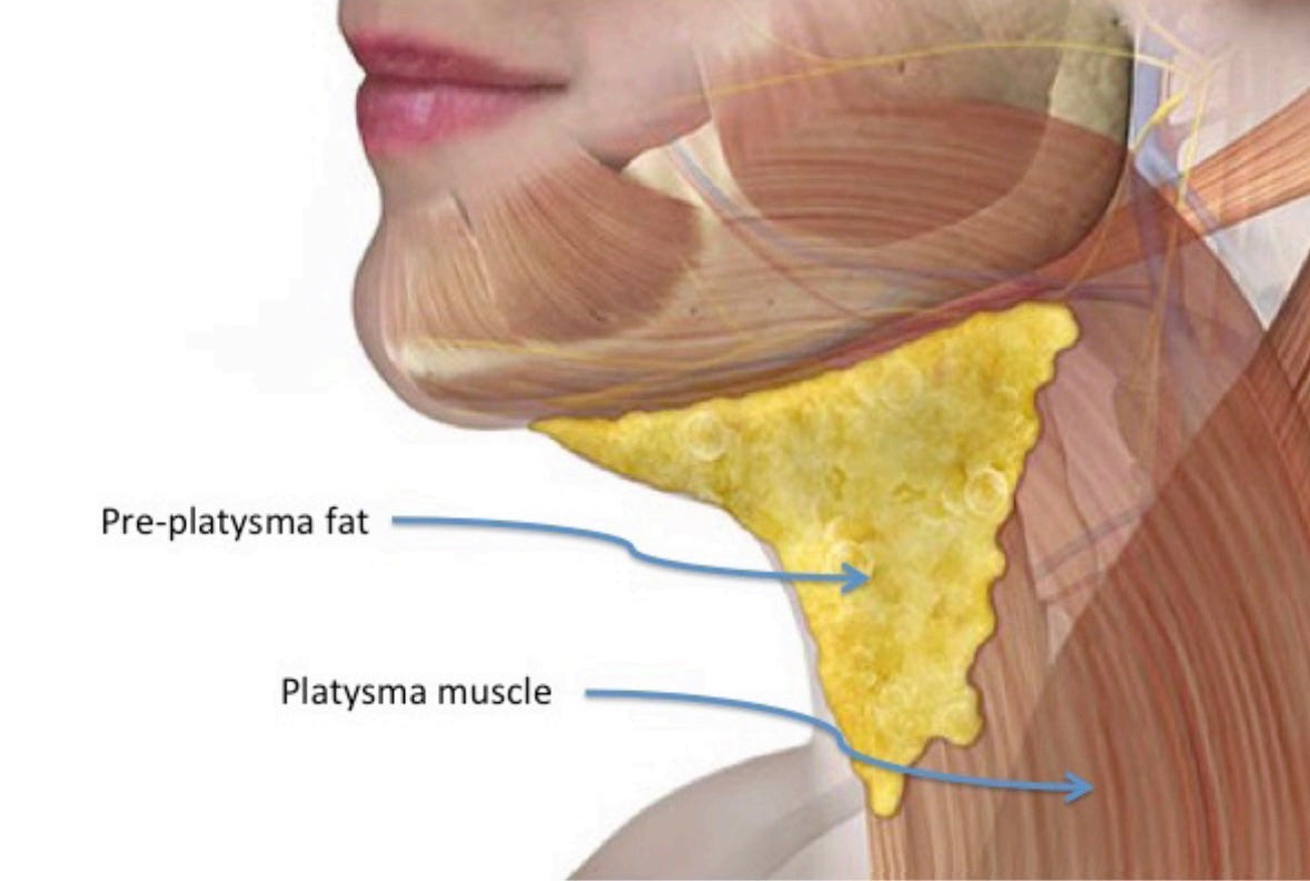 gordura pré-plastimal