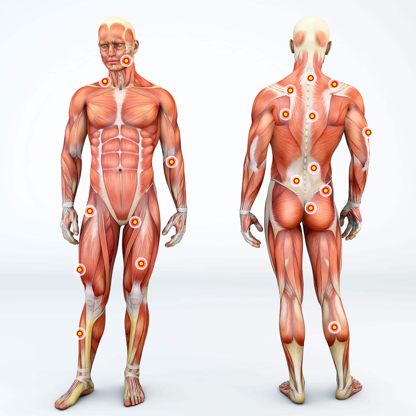 Most Common Trigger Points For Sciatica Sufferers in Lakewood, CO |  PostureWorks Chiropractic