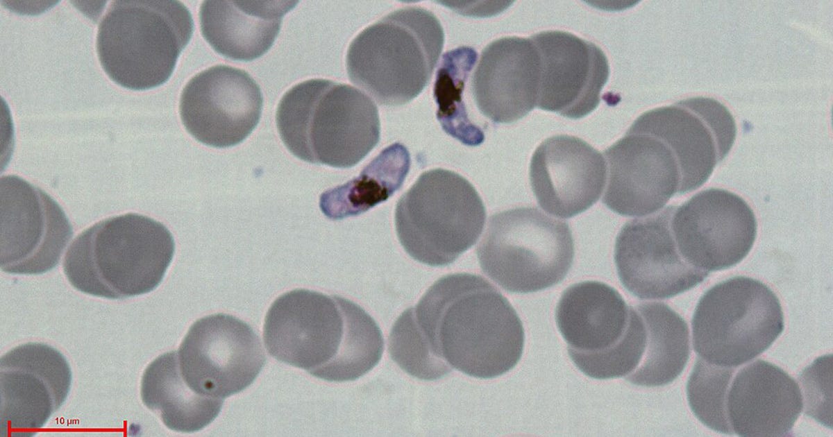 imagem de microscópio mostra o plasmodio falciparum entre os eritrócitos (células do sangue) imagem de microscópio mostra o plasmodio falciparum entre os eritrócitos (células do sangue)