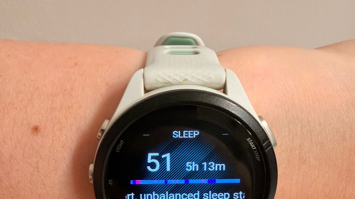 Your smartwatch is gaslighting you