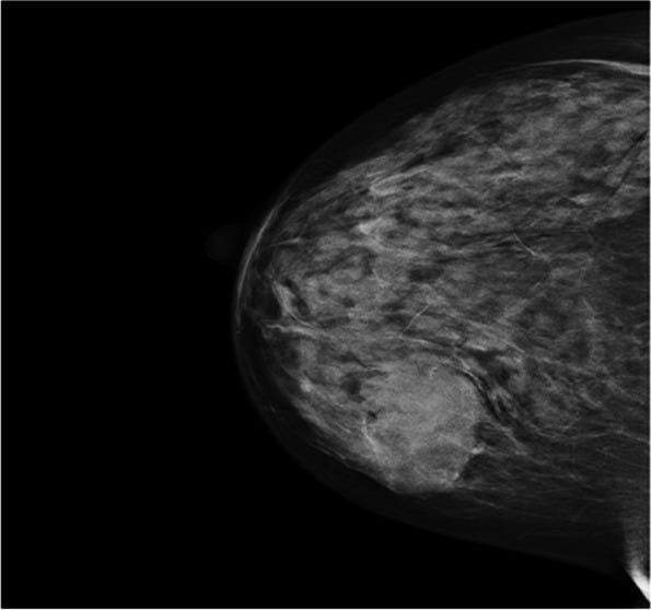 Fig. 1 Fig. 1