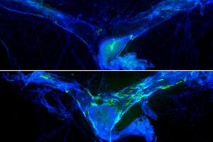lymph vessels