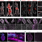 Mechanismen neuronaler Schäden durch die Covid modRNA-Produkte