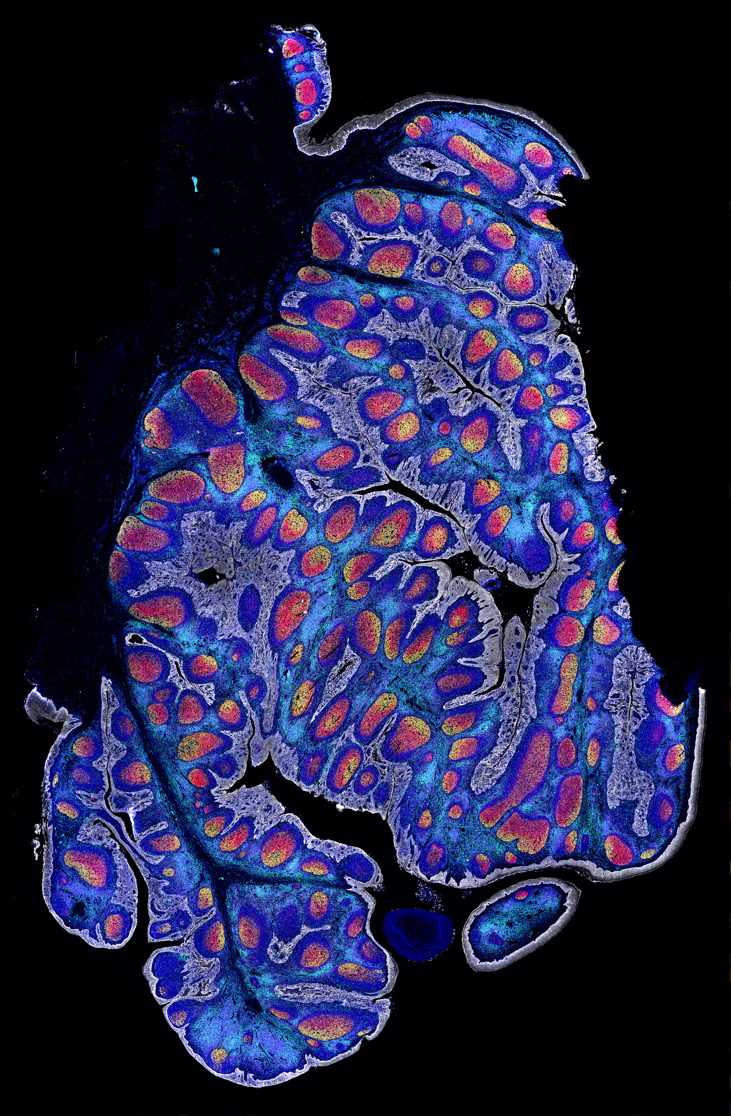Akoya Biosciences Announces Commercial Launch of PhenoCycler-Fusion, the  Fastest Single-Cell Spatial Biology System | Akoya Biosciences, Inc.