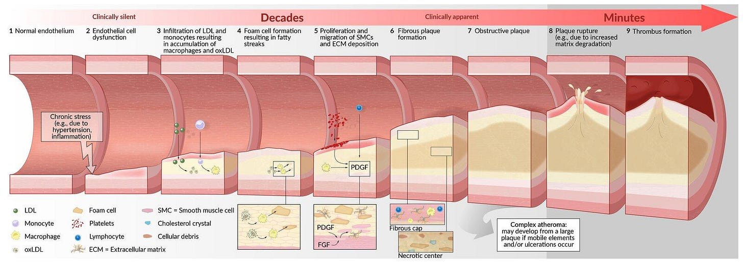 Lipid disorders<!-- --> - <!-- -->Knowledge<!-- --> @ AMBOSS