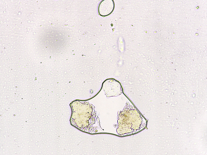 And More 'Things' in urine samples