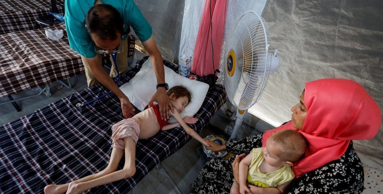 Over 60 Palestinian children died of starvation in Gaza due to Israeli blockade