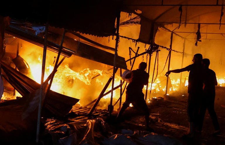 Burned Palestinian's relatives describe aftermath of Israeli attack Burned Palestinian's relatives describe aftermath of Israeli attack