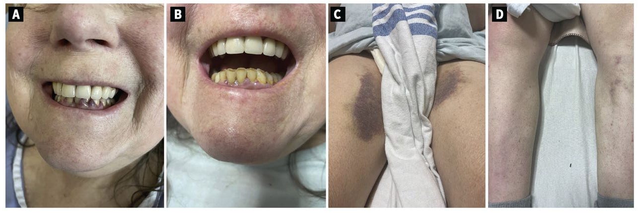 (Image courtesy Canadian Medical Association Journal) (Image courtesy Canadian Medical Association Journal)