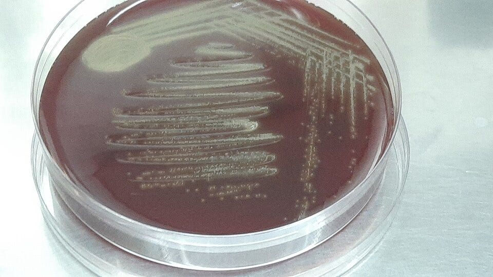 File:Gemella morbillorum colony characteristics on blood agar on subculturing from turbic BD BACTEC vial of blood specimen.jpg