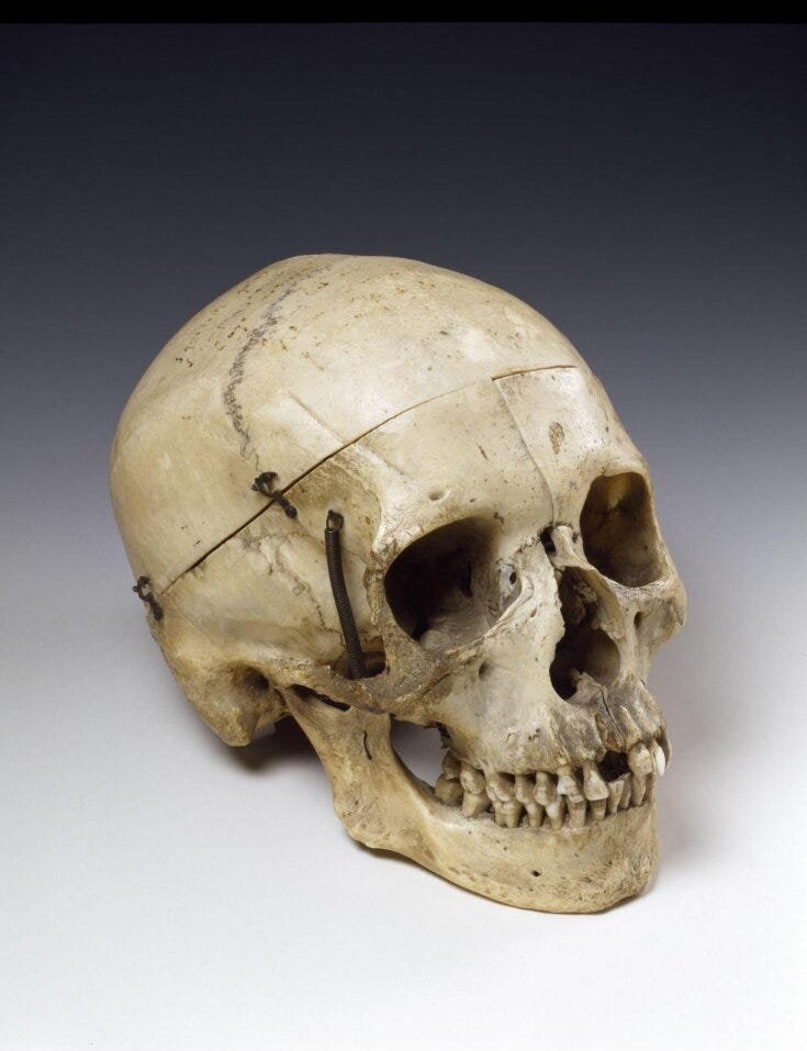 Skull top image