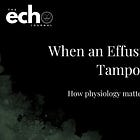 You Found an Effusion, Now What? Echo Recognition of Tamponade