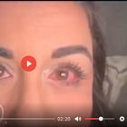 mRNA Nanoparticle Bioweapon in Action: “From the Inside Out My Body Was Just Falling Apart...”