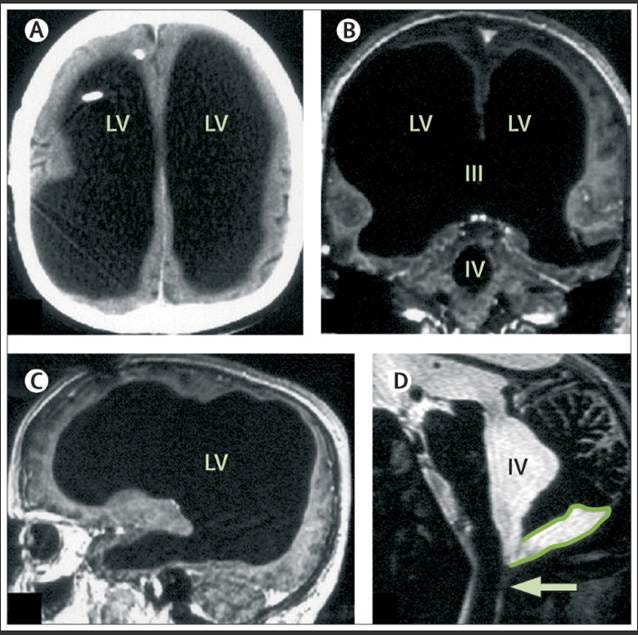 A close-up of a brain scan

AI-generated content may be incorrect.