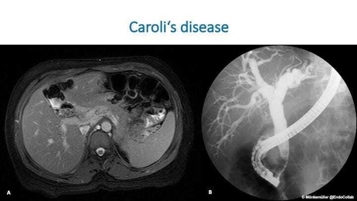 A close-up of a scan of a human body Description automatically generated
