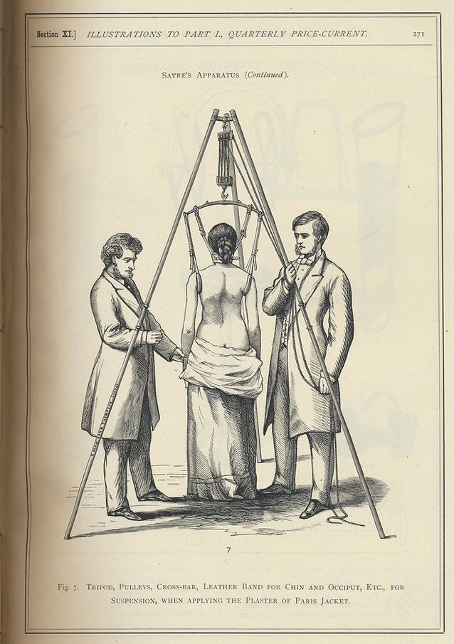 An illustration of what was used to help treat patients with back problems An illustration of what was used to help treat patients with back problems