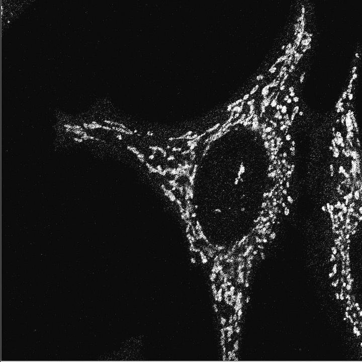 Mitochondrien unter dem Fluoreszenzmikroskop