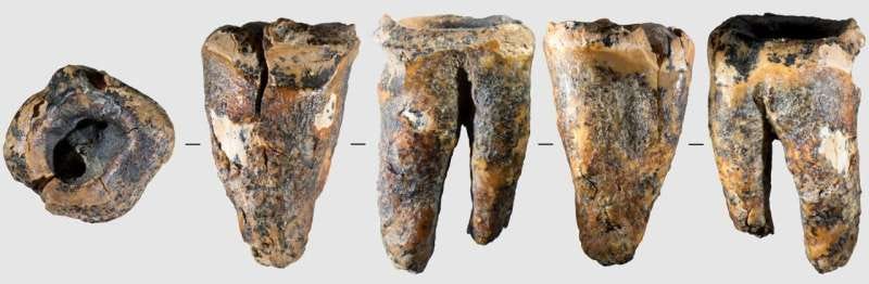 Neanderthal dentists used stone drills to treat cavities nearly 60,000 years ago