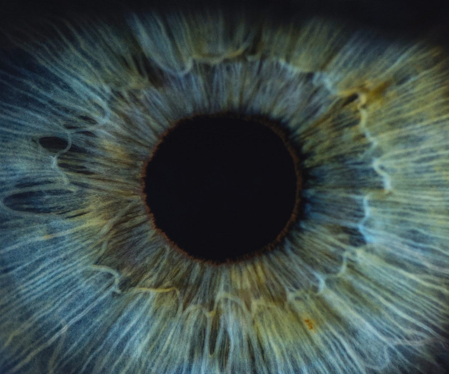 Do You Know the 3 Main Causes of Blindness in the U.S.?