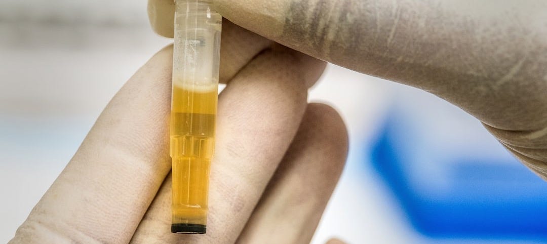 person holding yellow and clear tube person holding yellow and clear tube