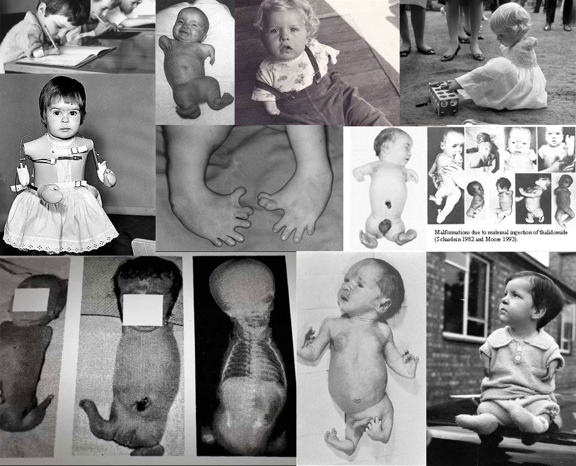 Victims of Thalidomide Victims of Thalidomide
