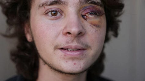 ICE attacking peaceful protesters and taking children from their family. Police attacking peaceful protesters in Selma, Alabama. 