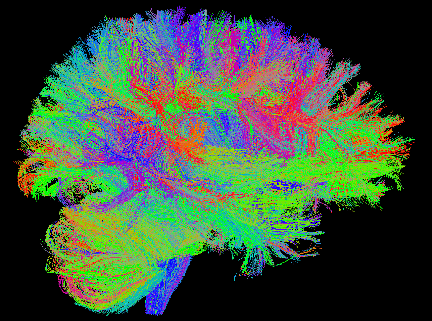 Can Computers Use Brain Scans to Diagnose Psychiatric Disorders? - Science  in the News