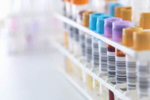 UT Health San Antonio Biggs Institute co-leads study finding new vascular links