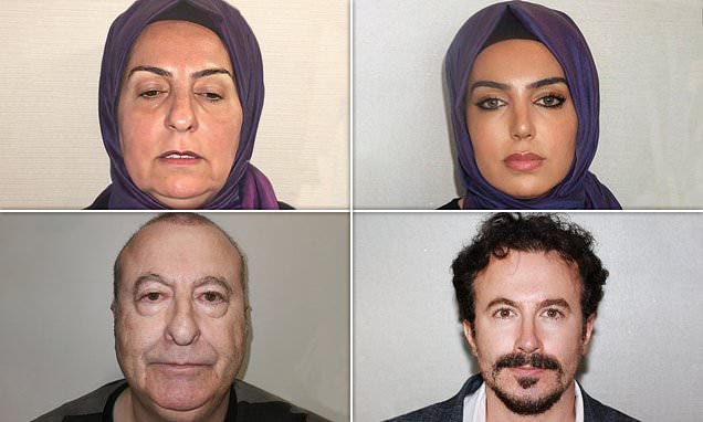 These are NOT the same people': As Turkish cosmetic clinic claims of  jaw-dropping transformations that make patients look '30 years younger'  leave social media users speechless, top plastic surgeons warn results are
