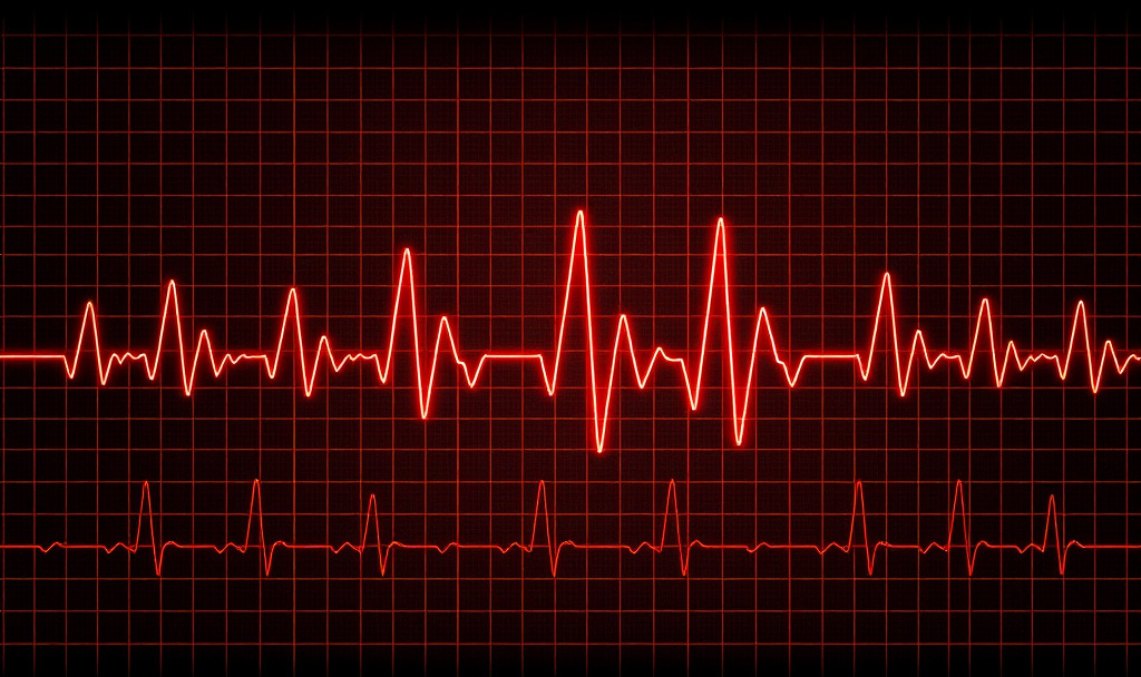 L’intelligenza artificiale applicata all’ECG: il costo della trasparenza