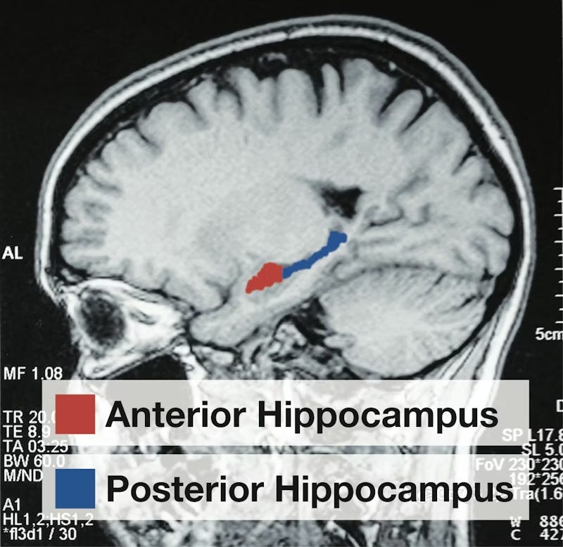 MRI brain scan highlighting the anterior hippocampus in red and the posterior hippocampus in blue, with corresponding labeled legend. MRI brain scan highlighting the anterior hippocampus in red and the posterior hippocampus in blue, with corresponding labeled legend.