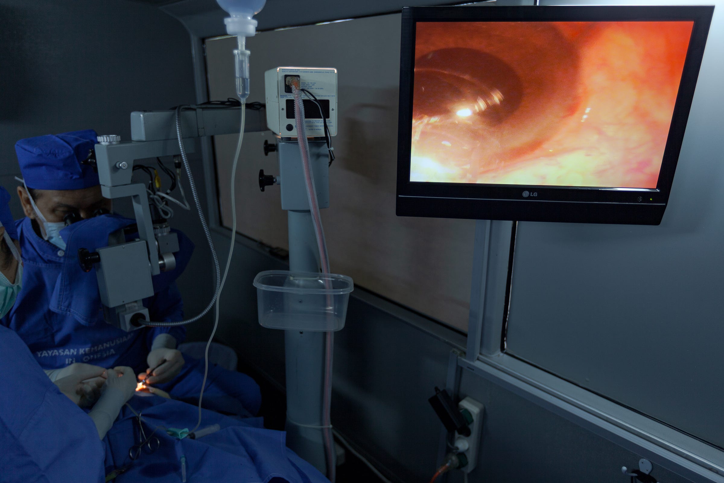 A replacement lens is inserted and positioned A replacement lens is inserted and positioned