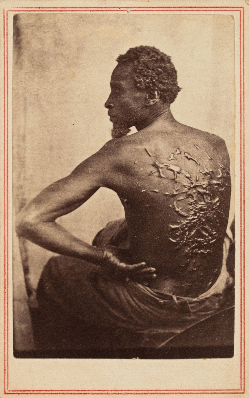 Shot in 1863, "Scourged Back" was a key image in abolitionists' anti-slavery campaigns during the American Civil War. Shot in 1863, "Scourged Back" was a key image in abolitionists' anti-slavery campaigns during the American Civil War.