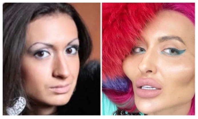 malar gigante malar gigante