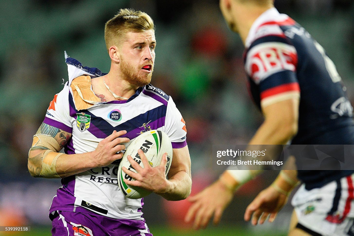 NRL Rd 14 - Roosters v Storm NRL Rd 14 - Roosters v Storm